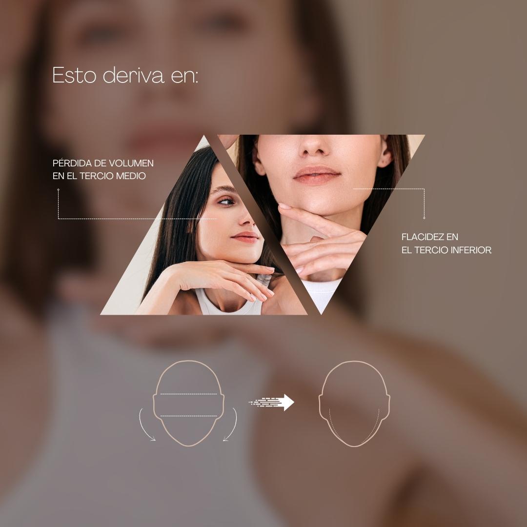 Triangulo De La Belleza (2)