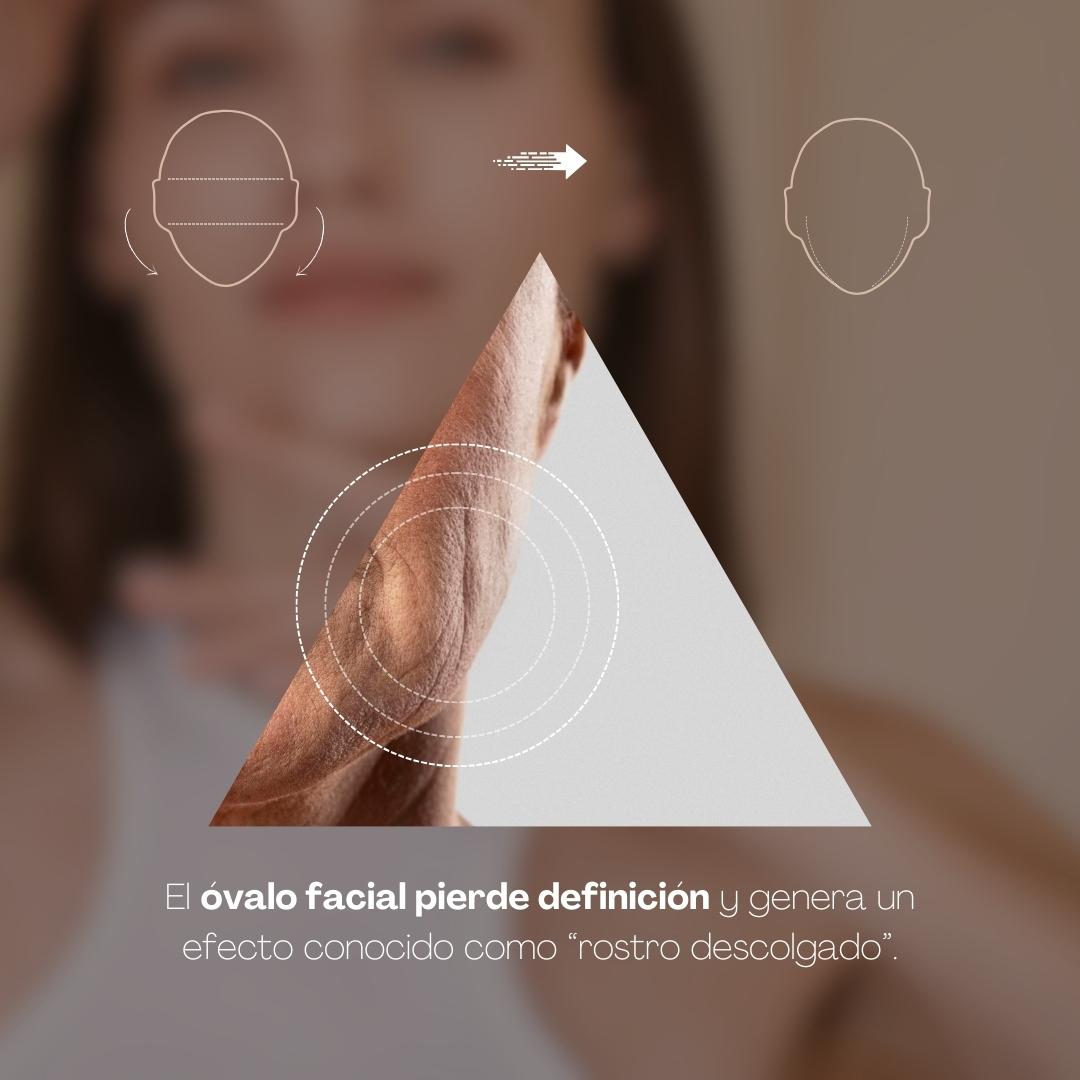 Triangulo De La Belleza (3)