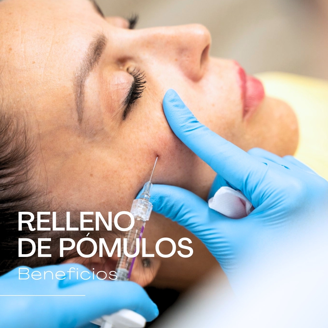 005 RELLENO DE POMULOS